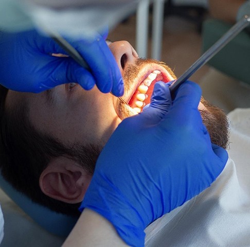 Jeffersonville dentist applying Arestin antibiotic gum disease treatment 