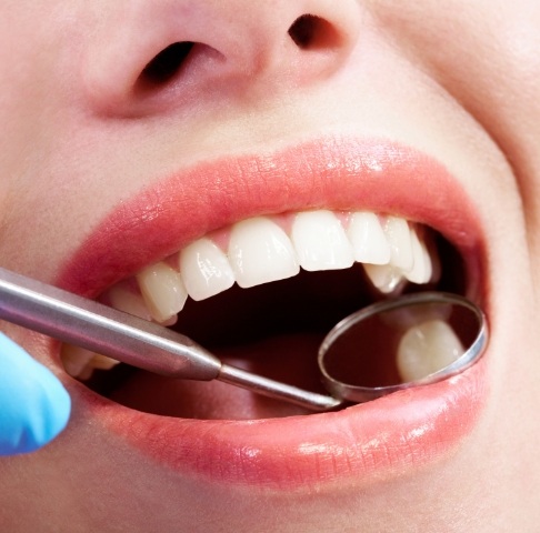 Dentist examining patient's smile after tooth colored filling restorative dentistry treatment