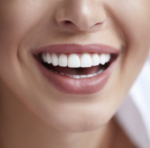 Woman sharing flawless smile after metal free dental crown restorations