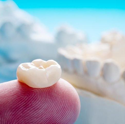 A dental crown in Jeffersonville sitting on a dentist’s fingertip