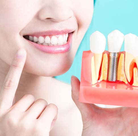 Closeup of woman holding model of dental implants in Jeffersonville