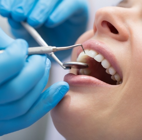 Patient receiving scaling and root planing periodontal therapy