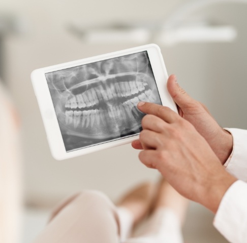 Digital dental x-rays on tablet computer