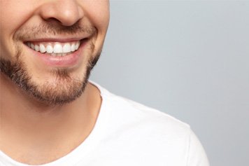 Closeup of a smiling man after cosmetic dental bonding 