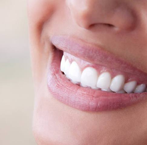 Closeup of beautiful smile with veneers in Jeffersonville